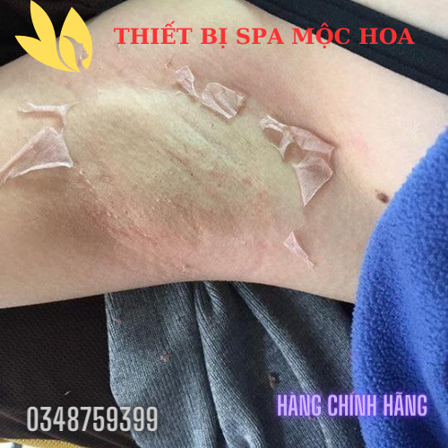 PEEL TCA Hỗ Trợ Làm Giảm Thâm Nách Bikini Làm Hồng Nhũ Hoa, Mông Bẹn