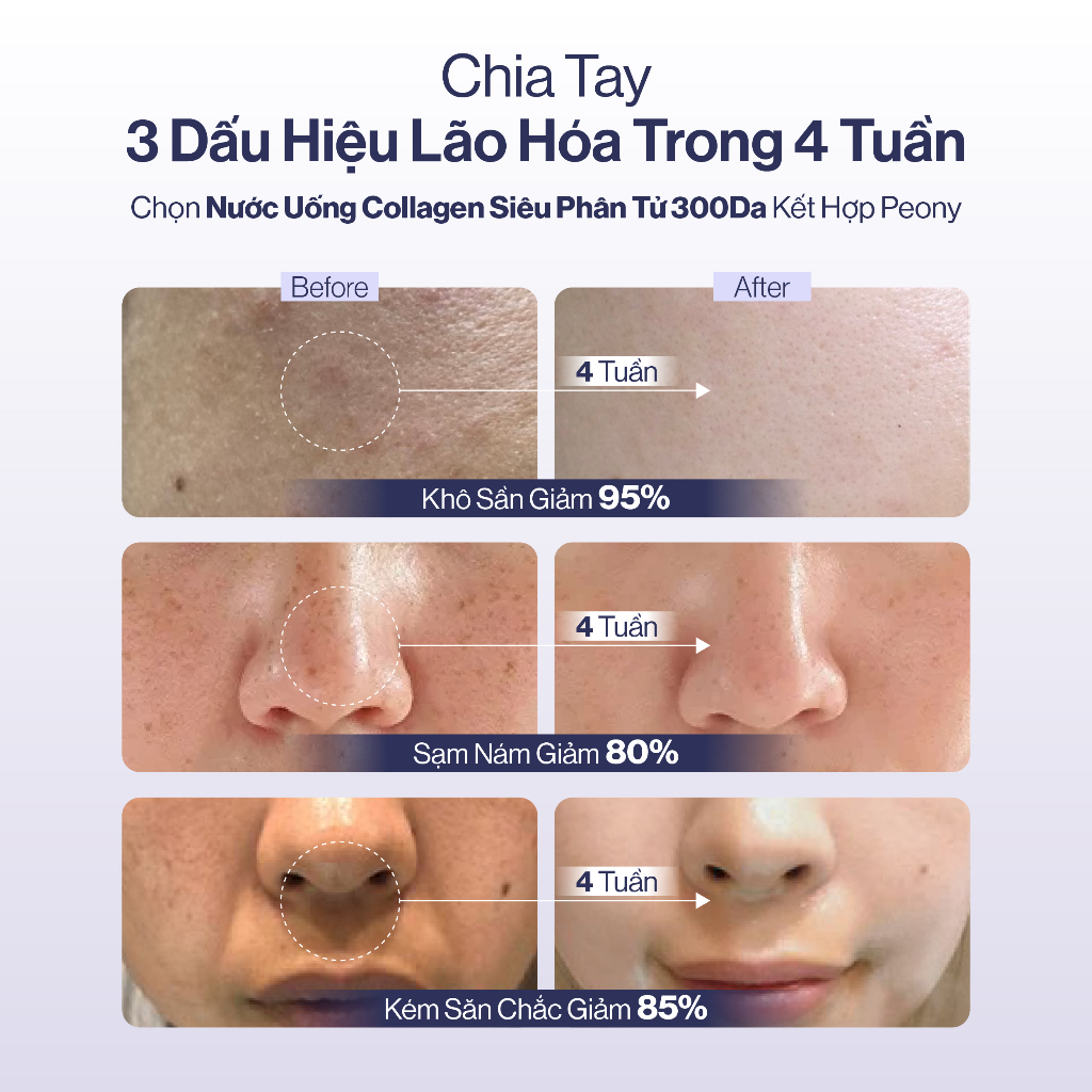 NƯỚC UỐNG COLLAGEN GILAA SIÊU PHÂN TỬ 300DA GILAA KẾT HỢP PEONY TRẺ HÓA CÂN BẰNG NỘI TIẾT (20g x 15 gói) | BigBuy360 - bigbuy360.vn