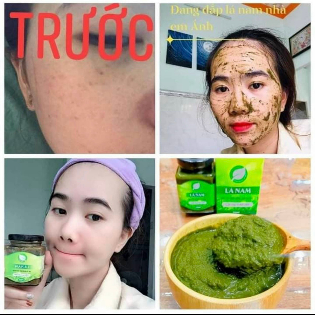 CAO LÁ NAM XOÁ NÁM, TÀN NHANG, THÂM MỤN tặng quà hấp dẫn