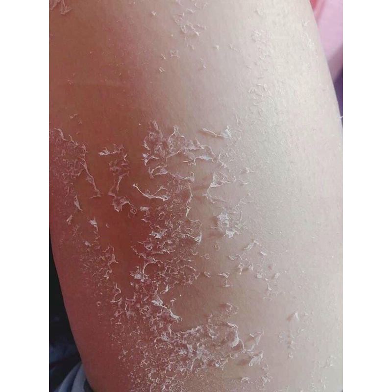 Kem bong da VIP 150gr