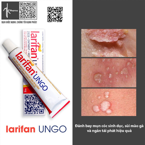 Larifan Ungo 10g Kem bôi Sùi mào gà, Mụn cóc sinh dục, Herpes.