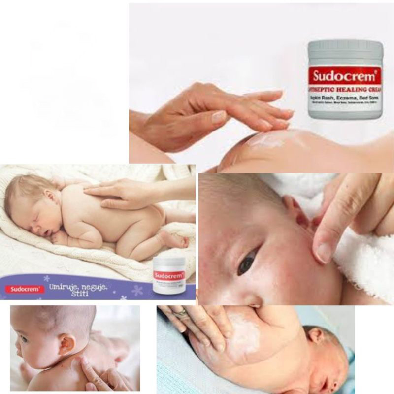 Kem hăm tã cho trẻ sơ sinh Sudocrem nội địa Anh 60g/125g Bảo vệ cái mông Sửa chữa da thịt Kích thích cách ly