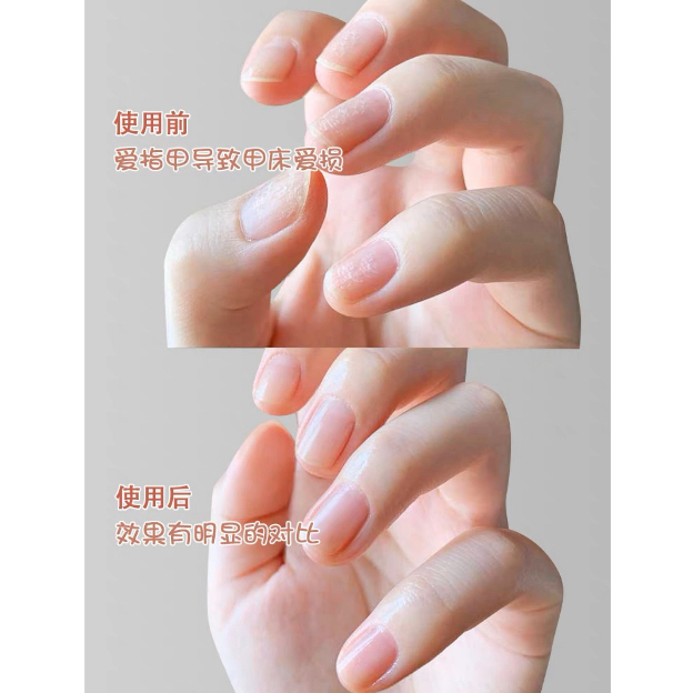 Bút oil dưỡng viền móng
