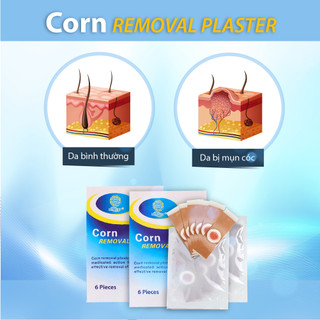 Dán Mụn Cóc Corn Removal Plaster (Hộp 6 miếng dán)