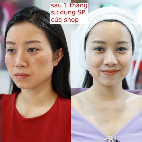 Viên Uống Trắng Da Mờ Nám Giảm Nếp Nhăn GLUTATHIONE 600 ĐR LACIR Hỗ Trợ Điều Trị Nám Tàn Nhang | BigBuy360 - bigbuy360.vn