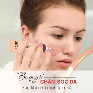 Kem chấm mụn lotion fob 10