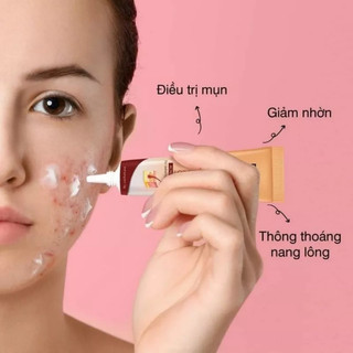 Kem chấm mụn lotion fob 10
