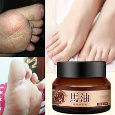 COMBO 2 HỘP 𝐓𝐡𝐮𝐨̂́𝐜 𝐭𝐫𝐢̣ 𝐧𝐚̂́𝐦 𝐧𝐠𝐮̛́𝐚 , 𝐚́ 𝐬𝐮̛̀𝐧𝐠 , 𝐯𝐢𝐞̂𝐦 𝐝𝐚 𝐜𝐨̛ đ𝐢̣𝐚 , 𝐧𝐮̛́𝐭 𝐧𝐞̉ 𝐜𝐡𝐚̂𝐧 𝐭𝐚𝐲 𝐝𝐚̂̀𝐮 𝐧𝐠𝐮̛̣𝐚 𝐜𝐡𝐢́𝐧𝐡 𝐡𝐚̃𝐧𝐠