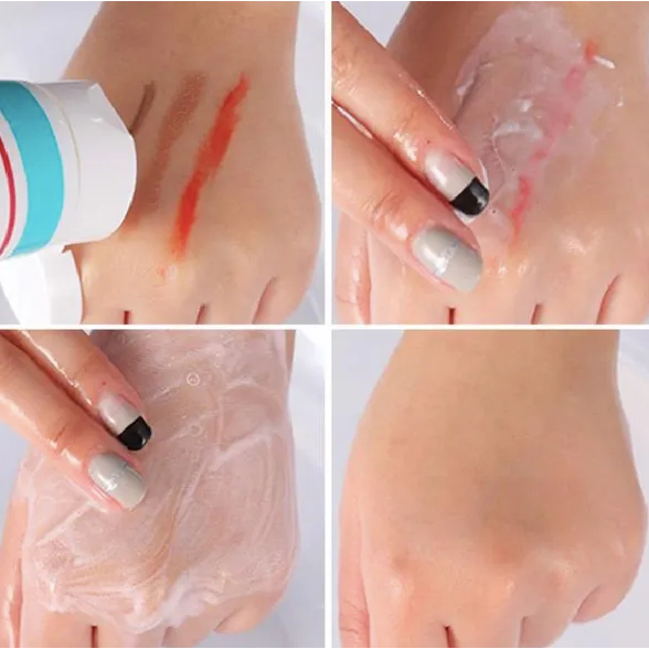 Combo Serum + Sửa Rửa Mặt Giảm Mụn, Phục Hồi, Làm Dịu Da LA Bonita Recover Acne Foam Cleanser 100mL Dành Cho Mọi Loại Da