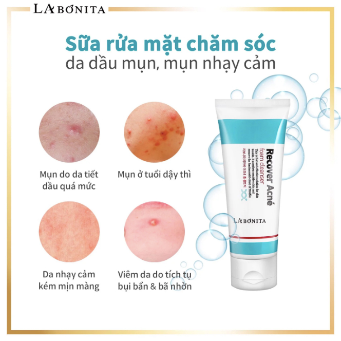 Combo Serum + Sửa Rửa Mặt Giảm Mụn, Phục Hồi, Làm Dịu Da LA Bonita Recover Acne Foam Cleanser 100mL Dành Cho Mọi Loại Da