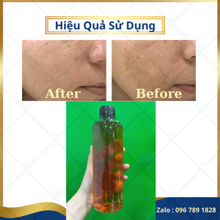 Thảo dược tái tạo da cam thảo