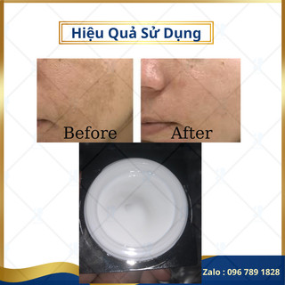 Kem nám cao cấp