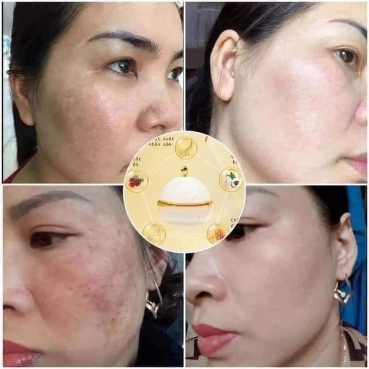 CAO NÁM CỐT THÔNG ĐỎ MAGIC SKIN