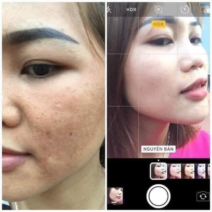 CAO NÁM CỐT THÔNG ĐỎ MAGIC SKIN