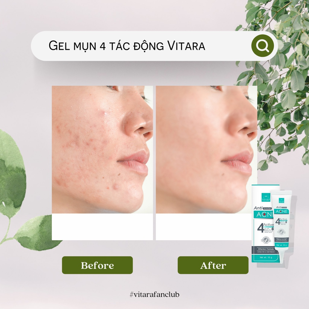 Gel bôi mụn 4 tác động VITARA ANTI ACNE GEL
