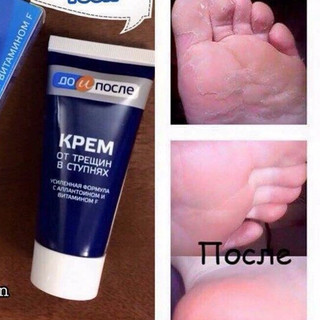 Kem dưỡng da tay chân, nứt gót chân Nga Kpem