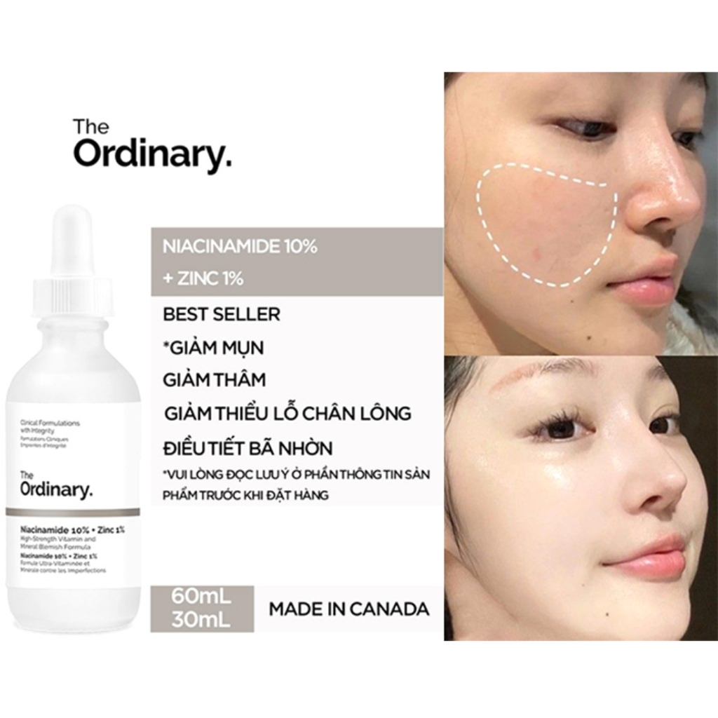 Serum The Ordinary Niacinamide 10% + Zinc 1% Giúp Cân Bằng Bã Nhờn Làm Sáng Da Thu Nhỏ Lỗ Chân Lông 30 - 60ml