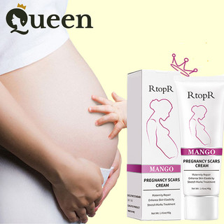 Kem dưỡng RtopR mango pregnancy scars cream 40g Phòng ngừa và làm mờ vết rạn da, vết béo phì