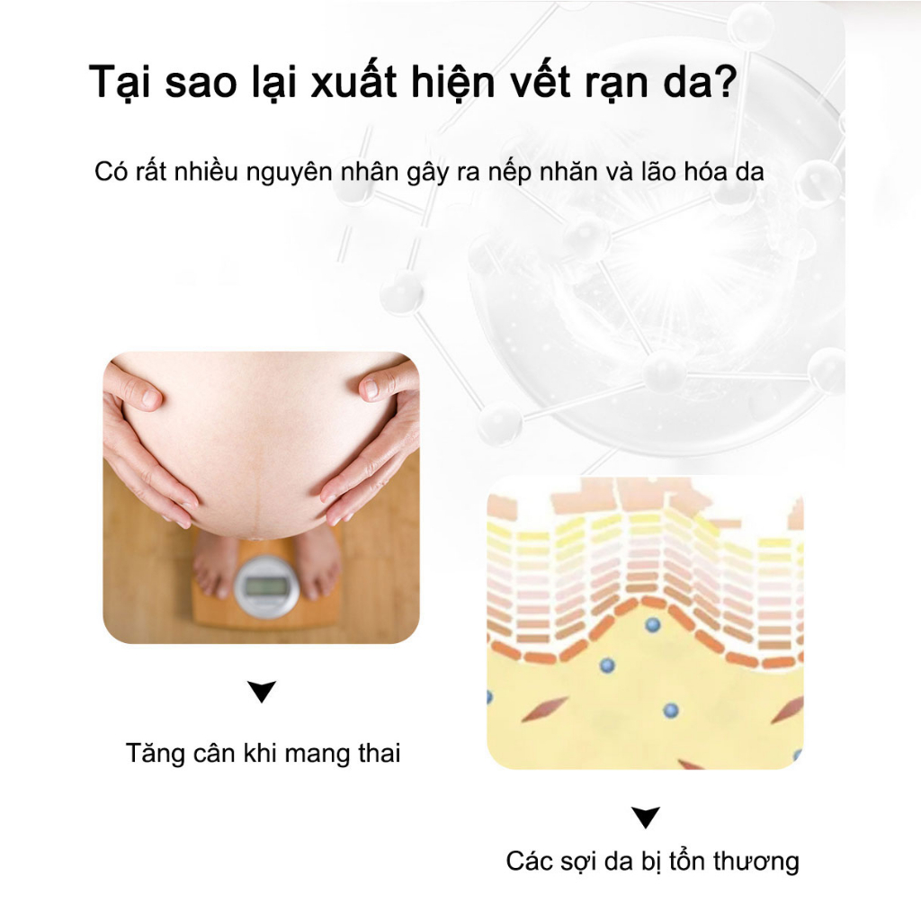 Kem dưỡng  RtopR mango pregnancy scars cream 40g Phòng ngừa và làm mờ vết rạn da, vết béo phì