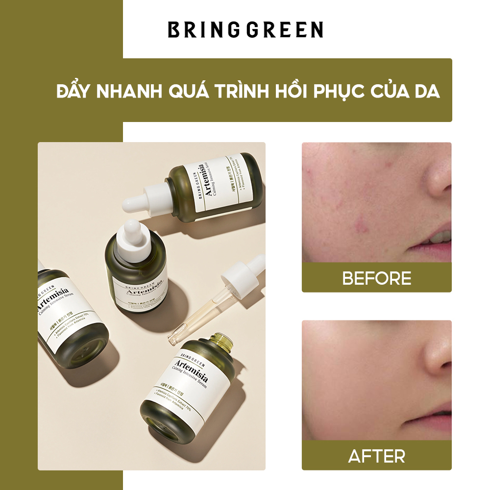 Tinh Chất Dưỡng Da Từ Ngải Cứu BRING GREEN ARTEMISIA CALMING INTENSIVE SERUM 40ml