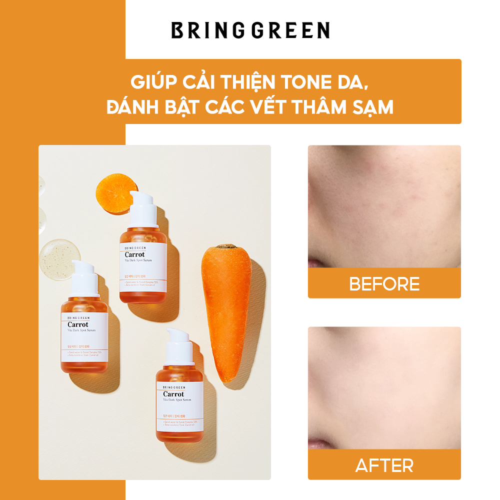 Tinh Chất Bring Green Carrot Vita Dark Spot Serum