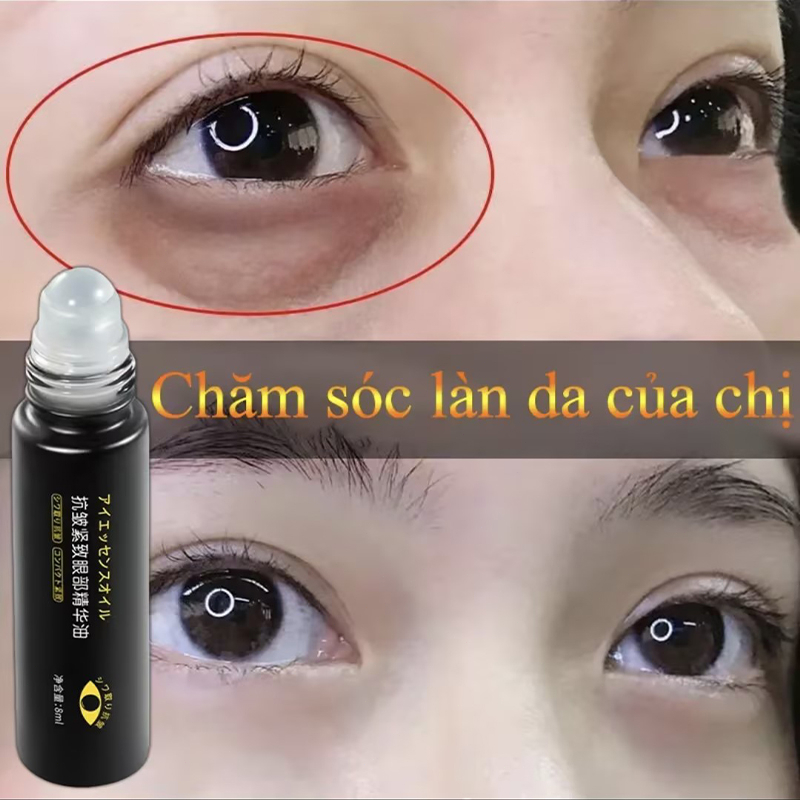 kem dưỡng mắt serum mắt Serum chống lão hóa 8ml Xóa nhăn quầng thâm bọng mắt và săn chắc da loại bỏ bọng mắt