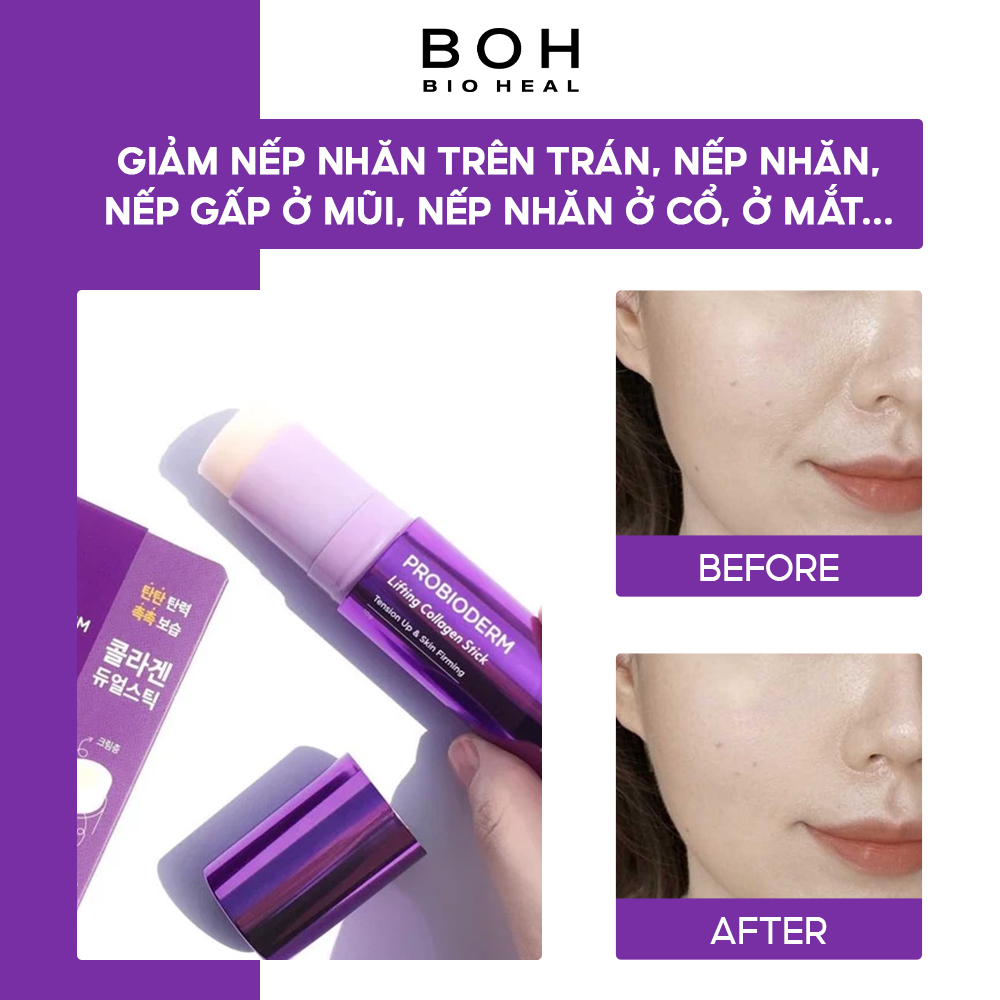 Thanh Lăn Làm Căng Và Săn Chắc Da BIOHEAL BOH PROBIODERM LIFTING COLLAGEN STICK 10g