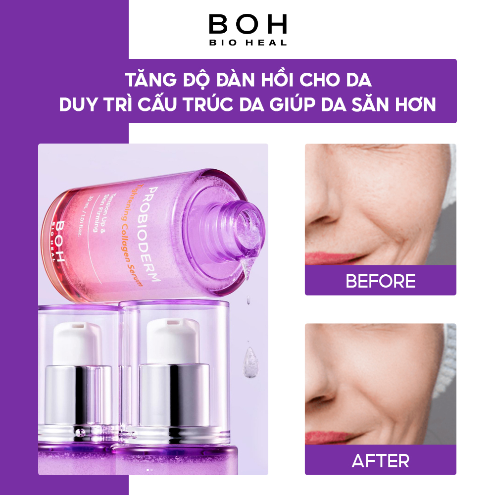 Tinh Chất Dưỡng Da Hỗ Trợ Thu Nhỏ Lỗ Chân Lông BIOHEAL BOH PROBIODERM TIGHTENING COLLAGEN SERUM 30ML (LIFTING CUP)