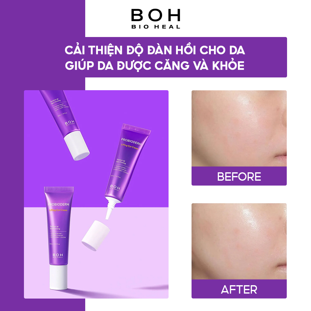 Kem Dưỡng Mắt BIOHEAL BOH PROBIODERM LIFTING EYE & WRINKLE CREAM DOUBLE SET (30ML*2)