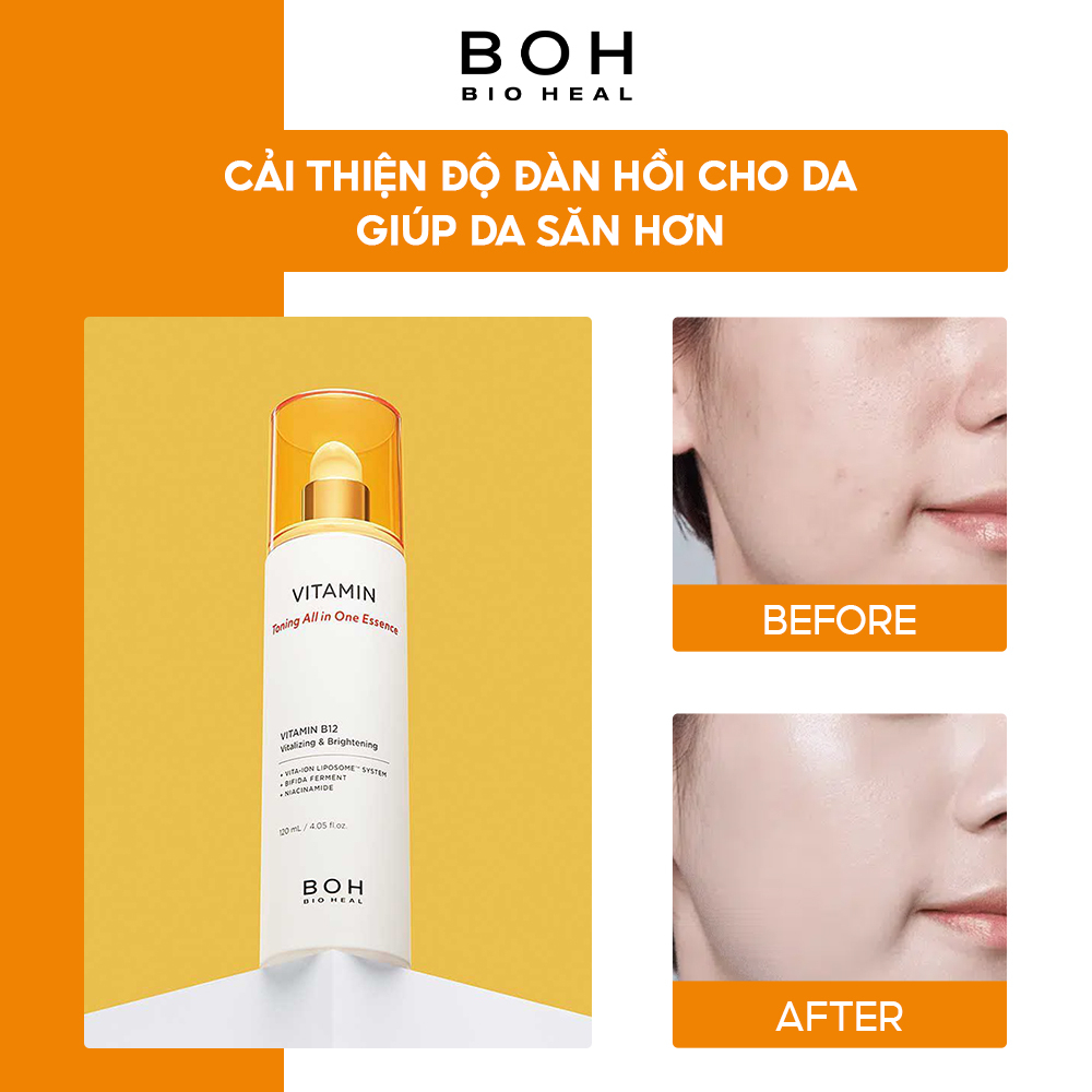 Tinh Chất Chiết Xuất Vitamin B12 Tăng Cường Sức Sống & Làm Sáng BIOHEAL BOH VITAMIN TONING ALL IN ONE ESSENCE 120ml