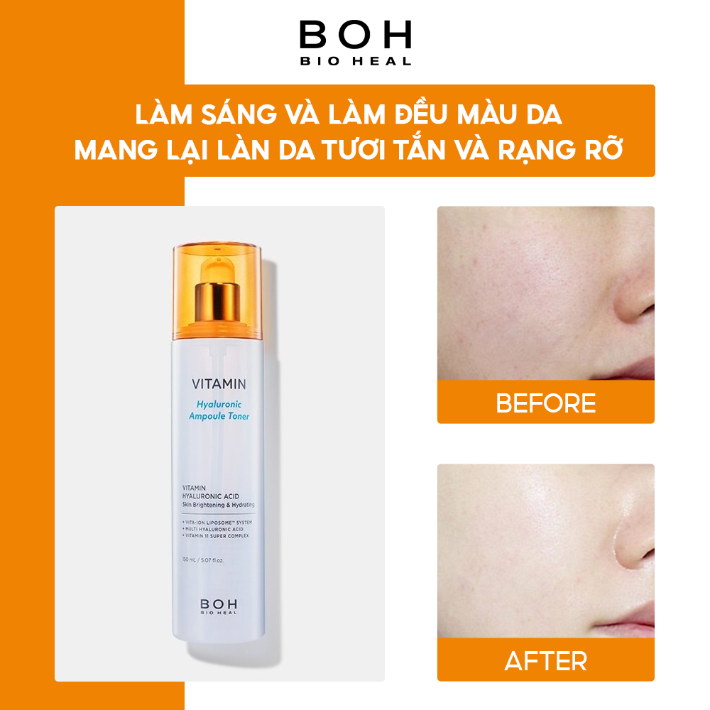 Nước Hoa Hồng Hyaluronic Dưỡng Ẩm & Làm Sáng Da BIOHEAL BOH VITAMIN HYALURONIC AMPOULE TONER 150ml