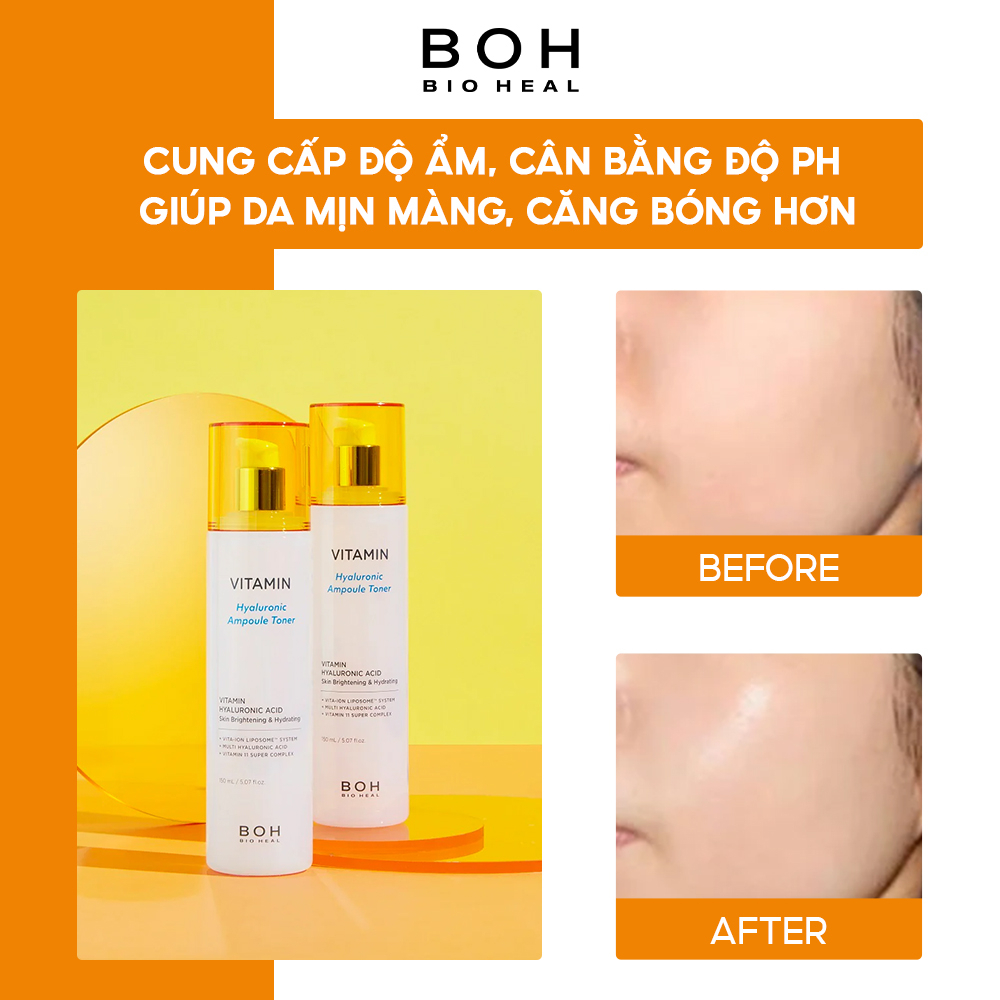 Nước Hoa Hồng Hyaluronic Dưỡng Ẩm & Làm Sáng Da BIOHEAL BOH VITAMIN HYALURONIC AMPOULE TONER 150ml