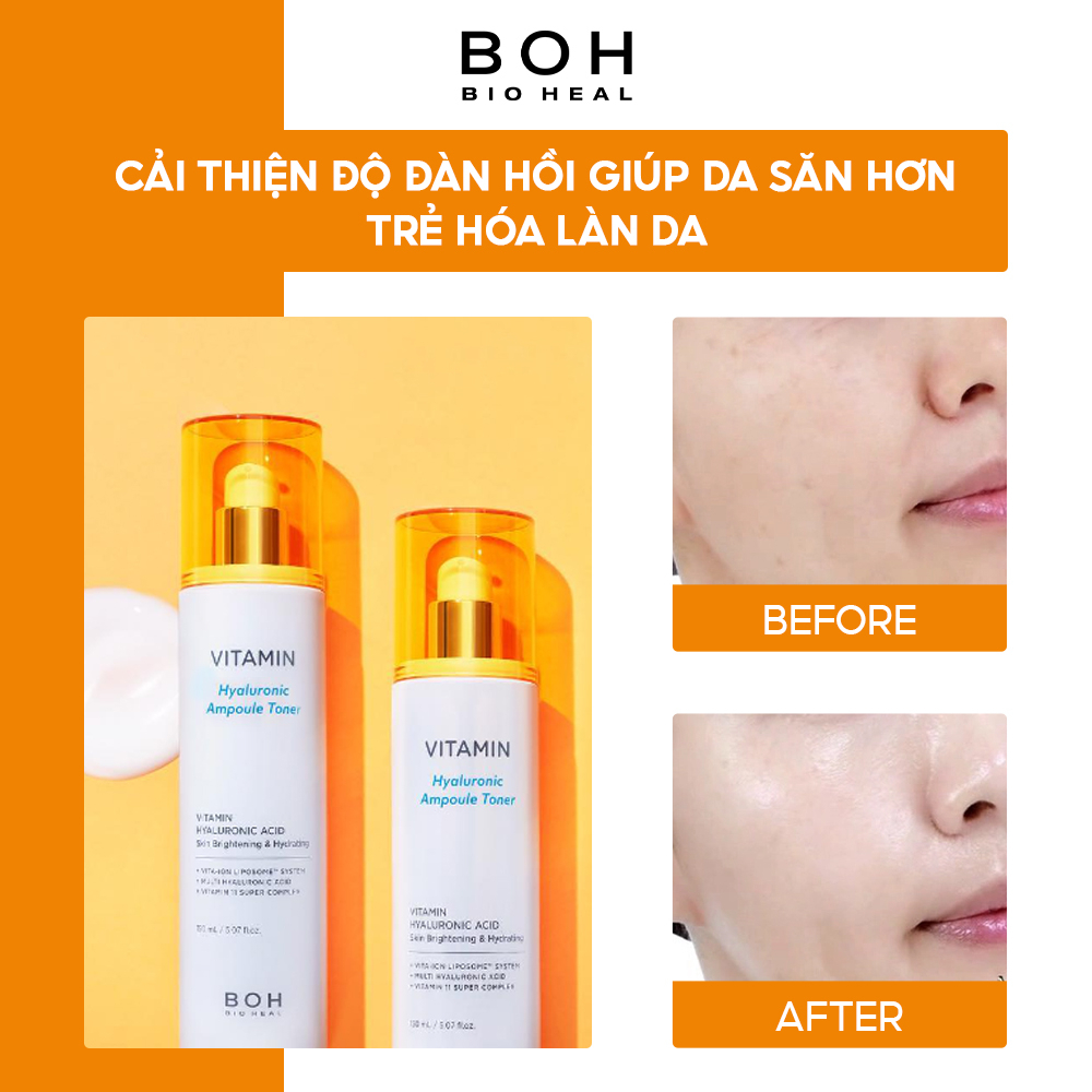 Nước Hoa Hồng Hyaluronic Dưỡng Ẩm & Làm Sáng Da BIOHEAL BOH VITAMIN HYALURONIC AMPOULE TONER 150ml