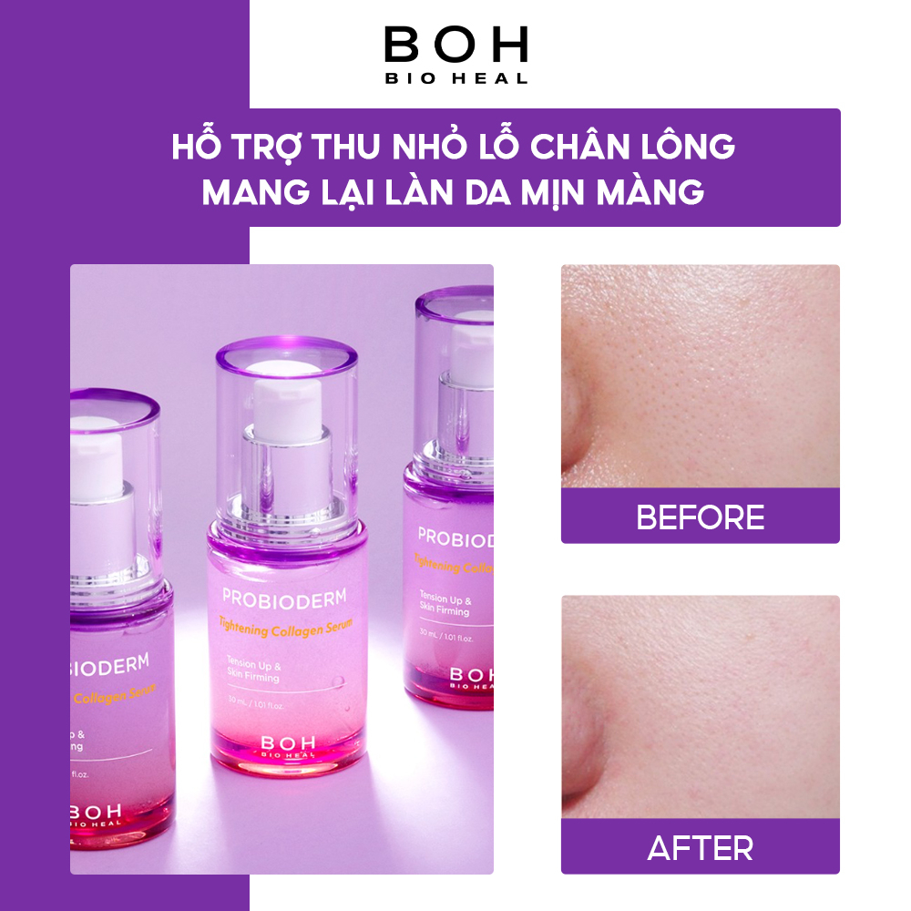 Tinh Chất Làm Săn Chắc Da BIOHEAL BOH Probioderm Tightening Collagen Serum 30ml (with Lifting Cup)