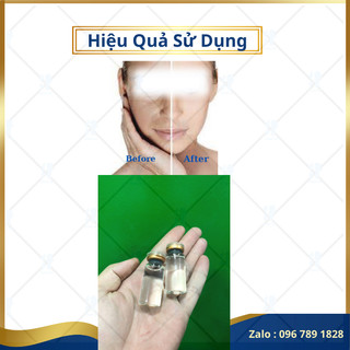 Serum cấp ẩm hyaluronic acid