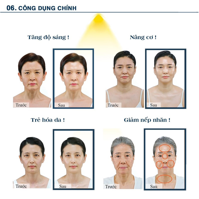 Mặt nạ căng bóng 90s