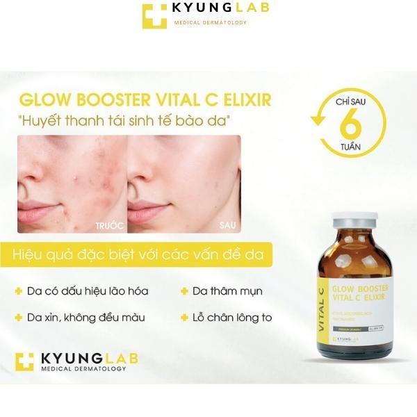 Vitamin C KyungLab, serum trắng da vital c 30ml kyung lab, huyết thanh tái sinh da, xóa nám, nếp nhăn, thâm mụn, lão hóa