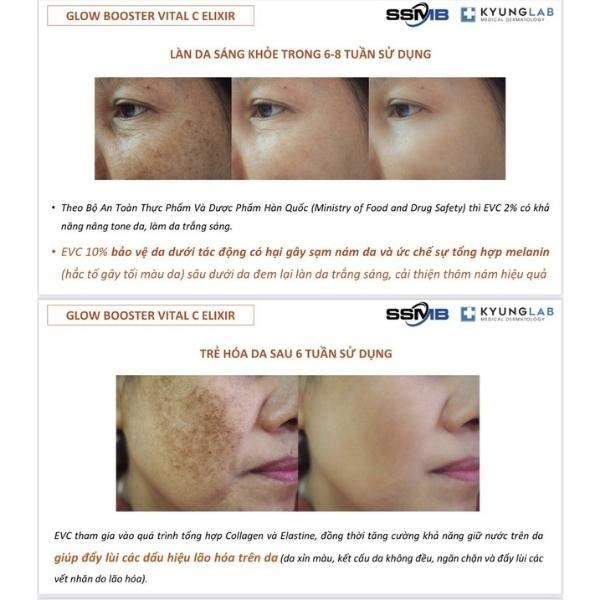 Vitamin C KyungLab, serum trắng da vital c 30ml kyung lab, huyết thanh tái sinh da, xóa nám, nếp nhăn, thâm mụn, lão hóa