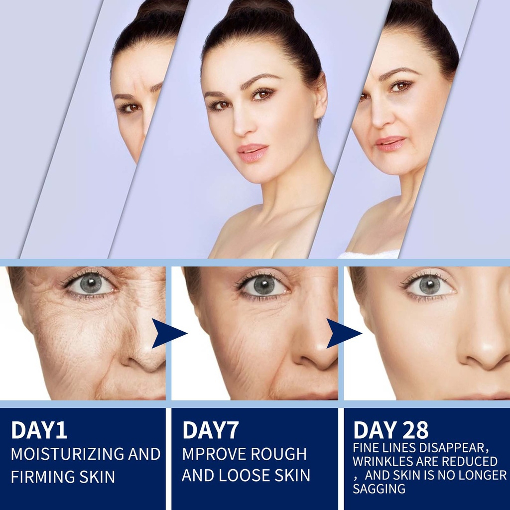 Kem UCM Trẻ Hóa Da, Xóa Nhăn, Mờ Nám, Tàn Nhang Nội Địa Nhật