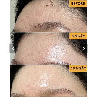 Bột rửa mặt NEEDLY MILD ENZYME CLEANSING POWDER