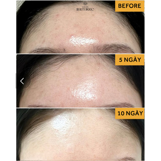 Bột rửa mặt NEEDLY MILD ENZYME CLEANSING POWDER