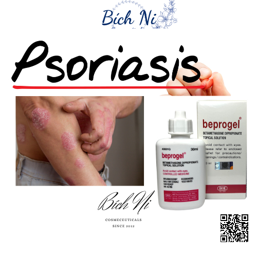 Beprogel 30ml hàng chính hãng hỗ trợ giảm Chàm, Vảy nến, Nấm da đầu.