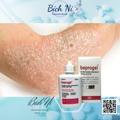 Beprogel 30ml hàng chính hãng hỗ trợ giảm Chàm, Vảy nến, Nấm da đầu.