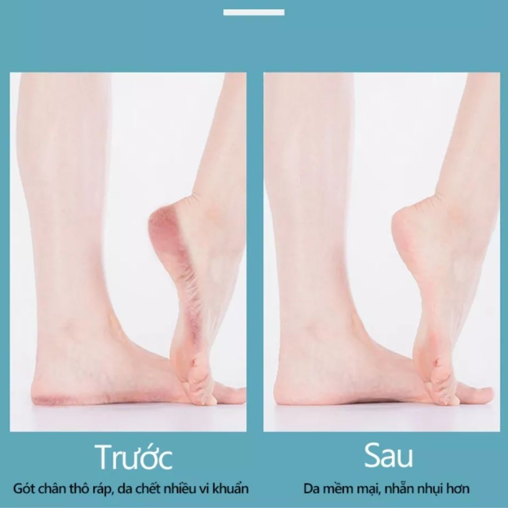 Máy chà gót chân JUSUKE động cơ mạnh mẽ pin dung lượng cao bảo hành 1 năm