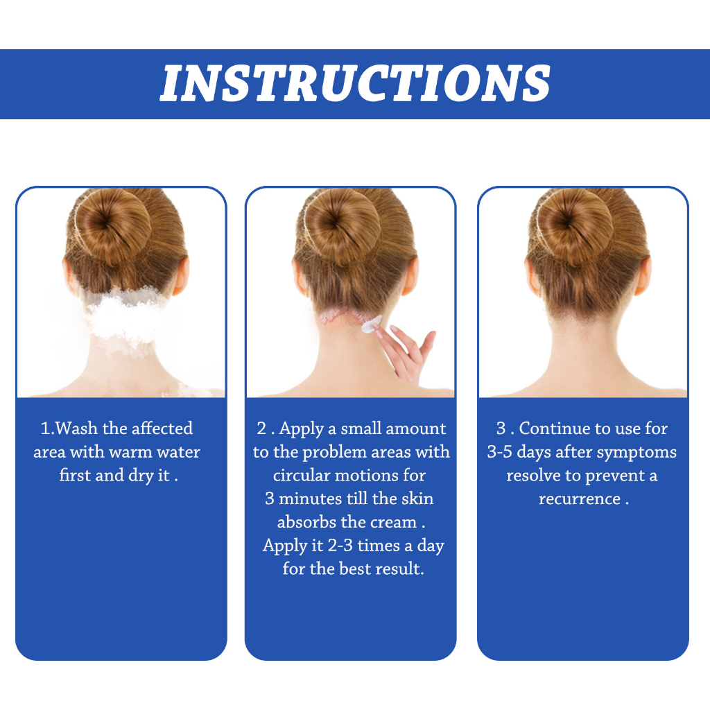 Nấm da đầu kem bôi nấm ngứa da đầu bong tróc vảy trắng hiệu quả lâu năm không tái phát -50gr