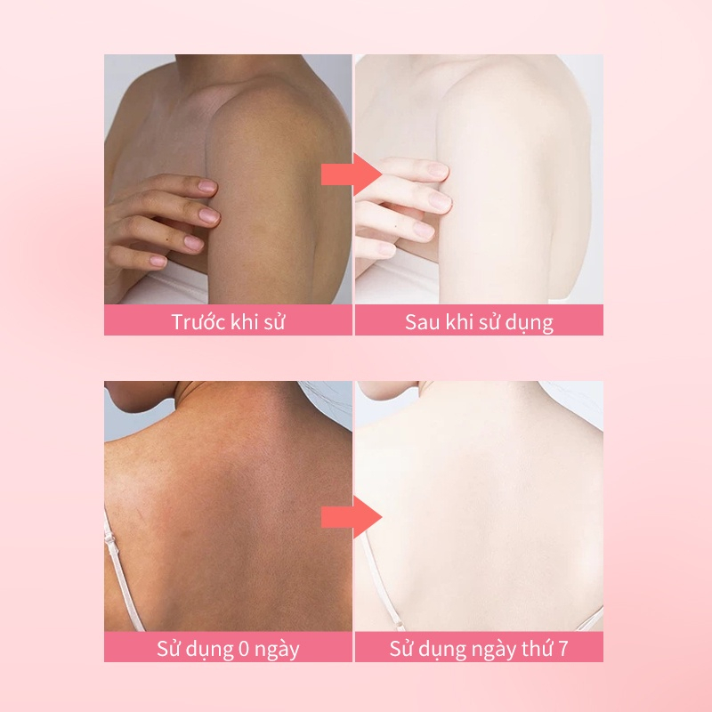 Kem Dưỡng Nách GMEELAN Kem Dưỡng Body Đào Niacinamide Lotion 150g Dưỡng ẩm Sáng Da Cream