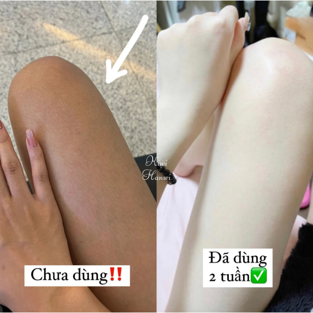 Kem kích trắng body vaseline glu 70x hũ 200g