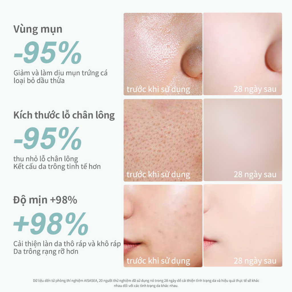 Bộ đôi Nước tẩy trang AISASEA  Cho Da Dầu  Centella Da nhạy cảm Làm sạch sâu Micellar 500mlx2