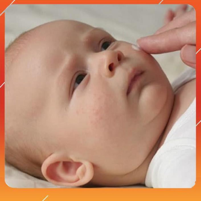 Kem bôi chàm sữa nấm ngứa cho bé