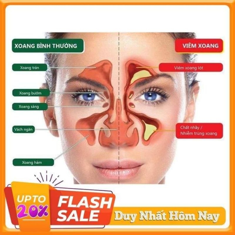 Xịt Mũi Dophazolin